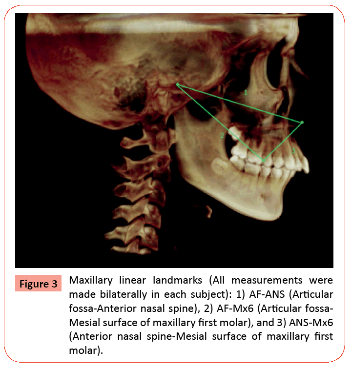 Orthodontics-Endodontics-Maxillary-linear-All-measurements