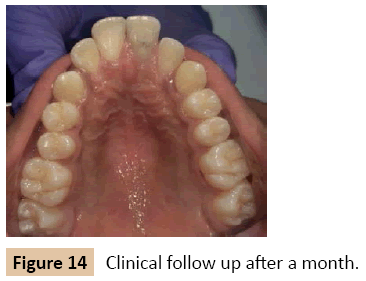 orthodontics-endodontics-Clinical-follow-up