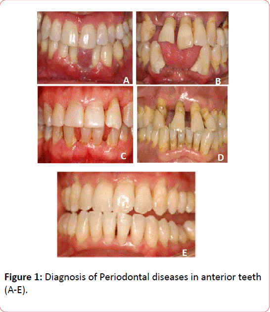 orthodontics-endodontics-Diagnosis-Periodontal