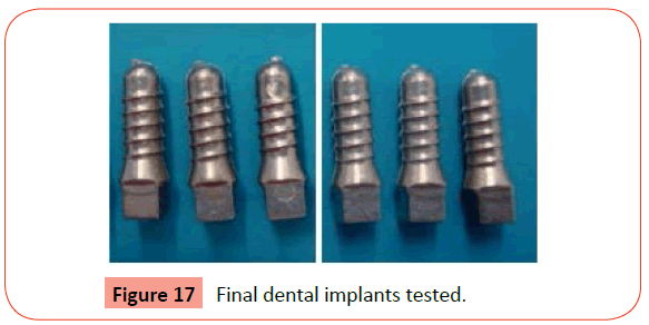 orthodontics-endodontics-Final-dental-implants