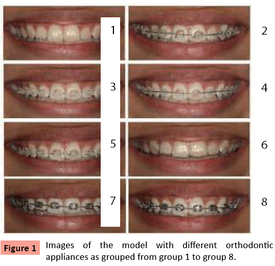 orthodontics-endodontics-Images-model-different-orthodontic