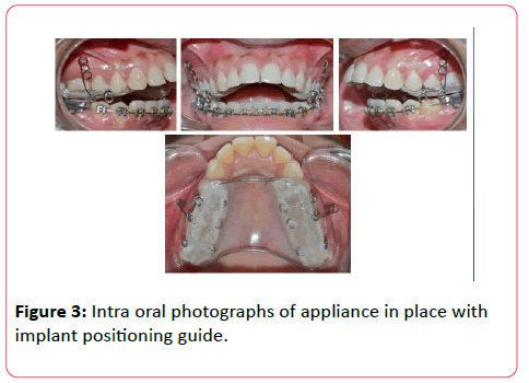 orthodontics-endodontics-Intra-oral-photographs