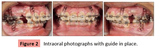orthodontics-endodontics-Intraoral-photographs-guide