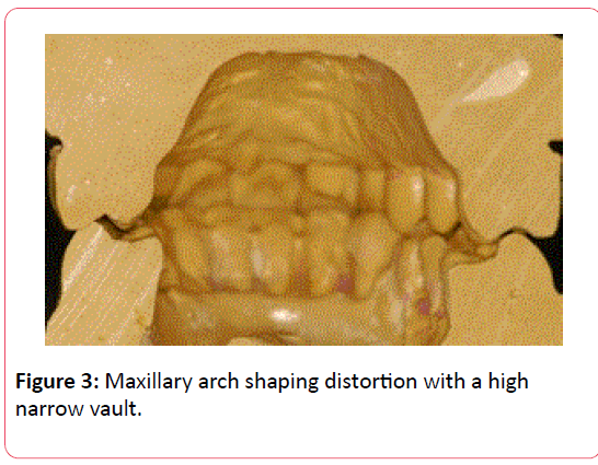 orthodontics-endodontics-Maxillary-arch