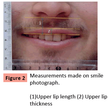orthodontics-endodontics-Measurements-made-smile