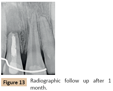 orthodontics-endodontics-Radiographic-follow-up