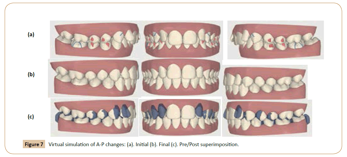 orthodontics-endodontics-Virtual-simulation