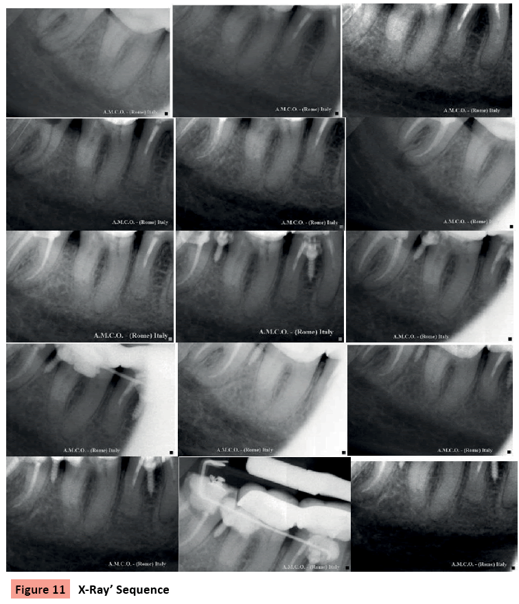 orthodontics-endodontics-X-Ray-Sequence