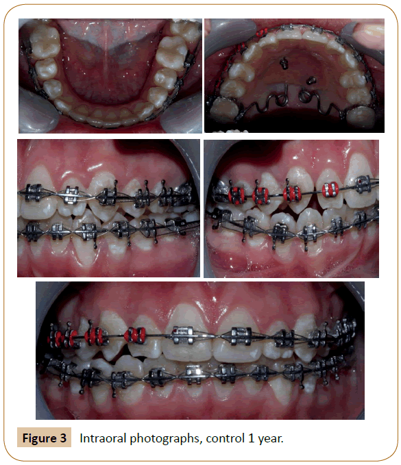 orthodontics-endodontics-control