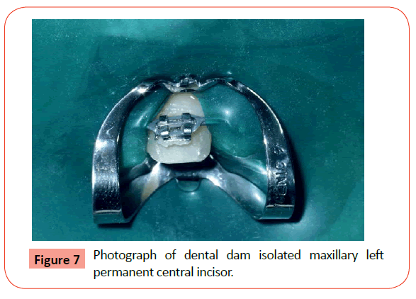 orthodontics-endodontics-dental-dam-isolated