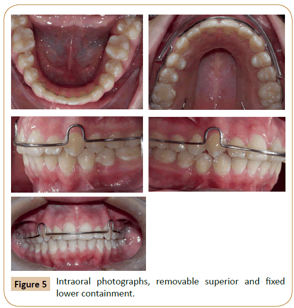 orthodontics-endodontics-lower-containment