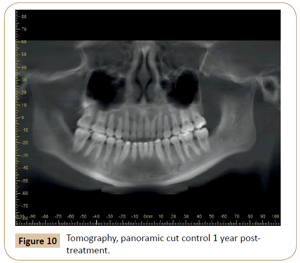 orthodontics-endodontics-panoramic