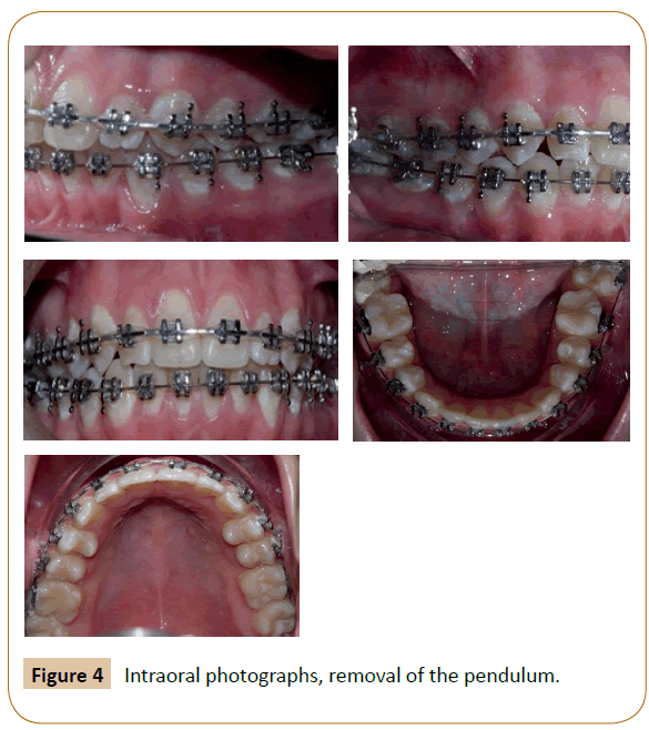 orthodontics-endodontics-pendulum