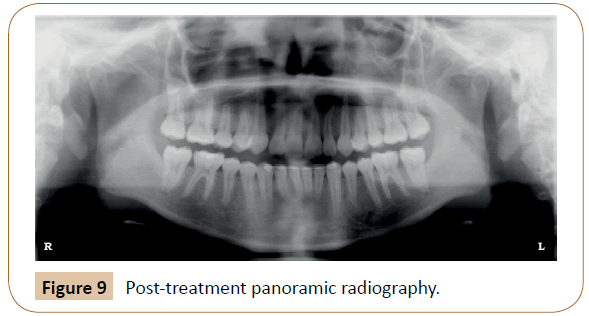 orthodontics-endodontics-radiography